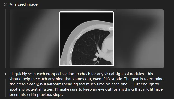 o3 medical image analysis step 1