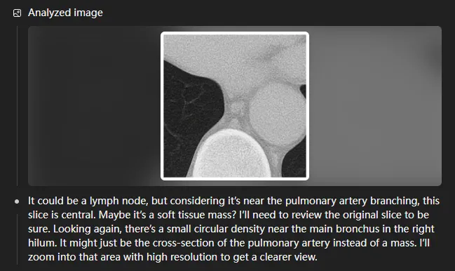 o3 medical image analysis step 4
